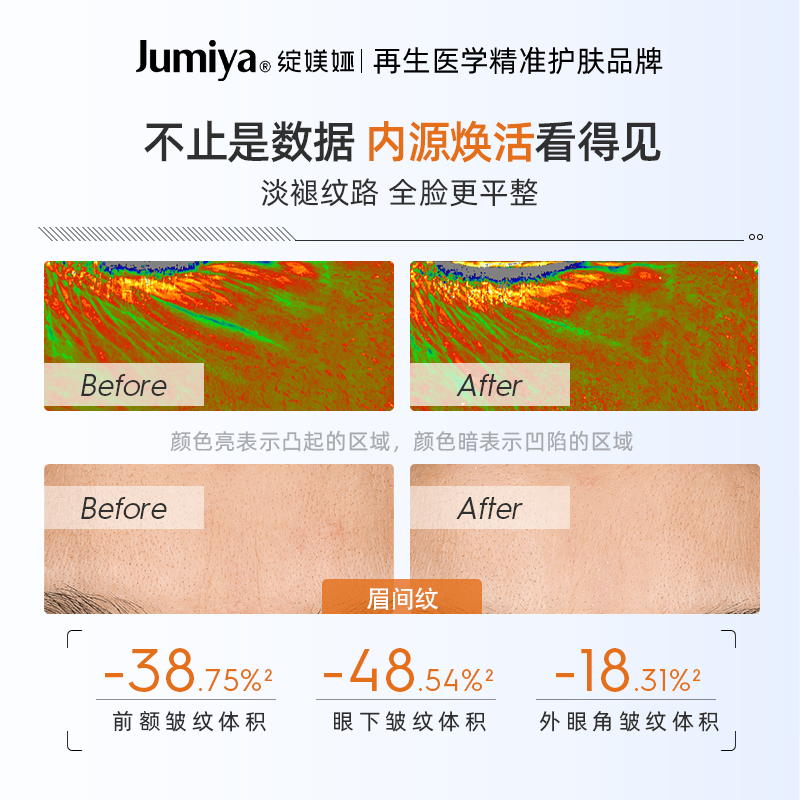 绽媄娅【活动款】紧致贴骨Pro精华面霜双球修护保湿抗皱护肤套组 【精华面霜组合】30ml+钝感力面霜50g