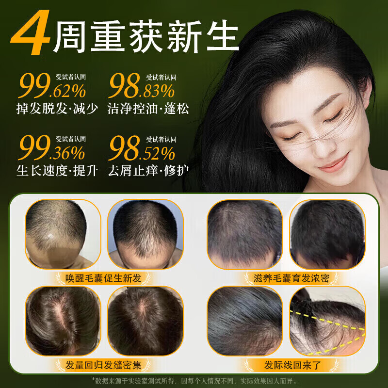 京东线上商城生姜侧柏叶防脱育发洗发水中药控油密发增发同款代购 两瓶装[针对严重脱发]4周见新发
