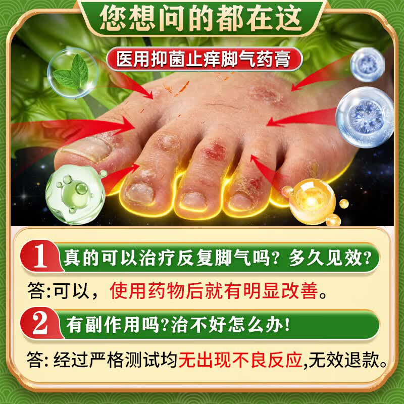 [嘉效]盐酸特比萘芬乳膏 1%*25g 2盒装 真菌感染等抗真菌药脚气药治疗止痒脱皮烂脚丫真菌感染根源治起小水泡痒特强效药 疗程装 脚底水泡脱皮