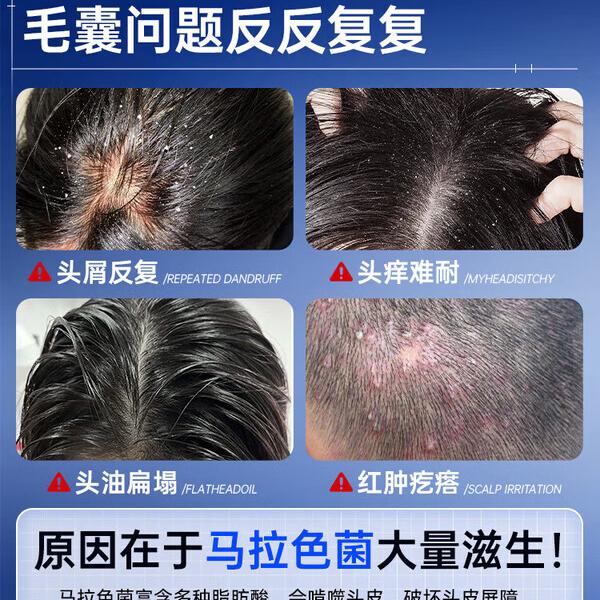 南京同仁堂二硫化硒洗发水去屑止痒控油持久蓬松滋养头皮毛囊清洁头屑无硅油 5瓶【买3赠2】