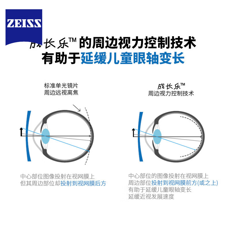 蔡司(ZEISS)成长乐儿童防控镜片减缓近视增长离焦防控多焦点眼镜片小孩子少年 蔡司 成长乐铂金膜【定制片】无散光+送镜框一副 1.60