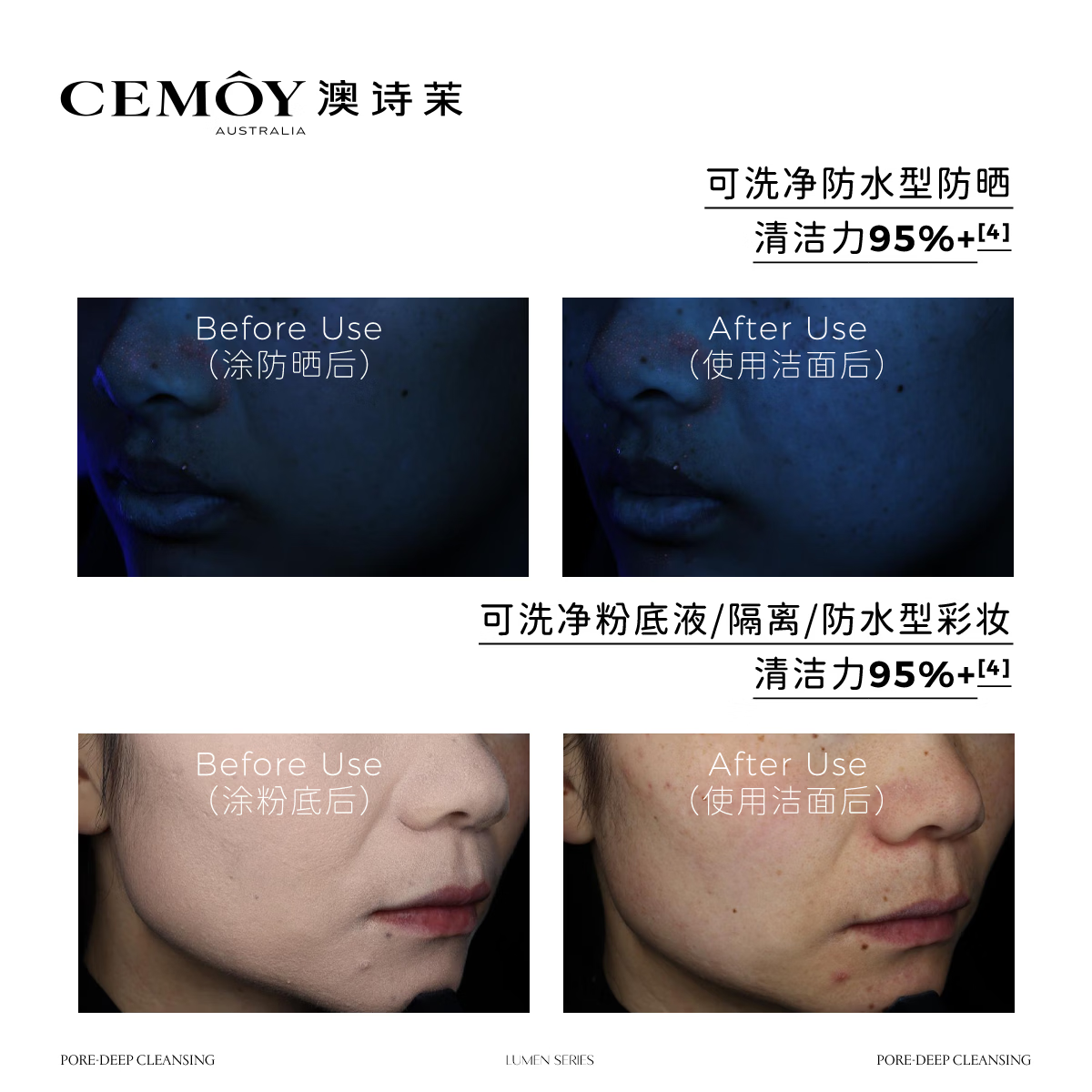 cemoy澳诗茉白金袋鼠爪花氨基酸洗面奶清洁卸妆养肤控油洁面乳泡沫绵密 【全新升级】白金洁面100g*2支