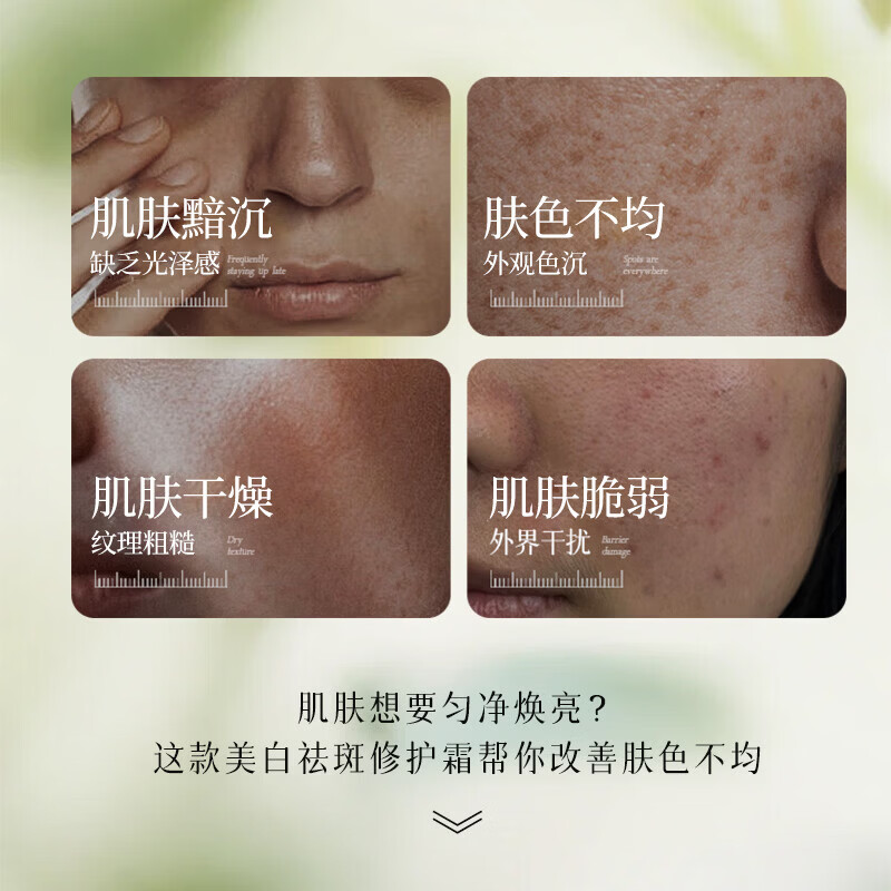 植仆 ZINGSERVE氨甲环酸乳膏美白祛斑霜修护博士科研淡化色斑点改善暗沉面霜 祛斑霜【第三支0元】30g*3支