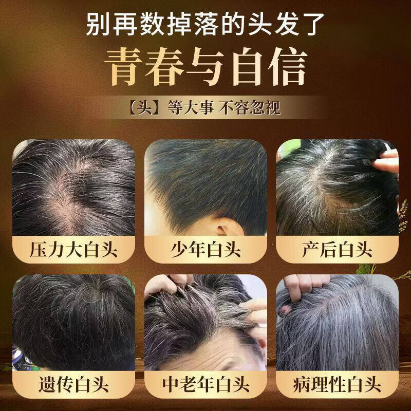 黄金搭档五黑维生素B6生物素含黑桑葚黑芝麻黑枸杞补充发丝营养膳食营养片 36g*1瓶
