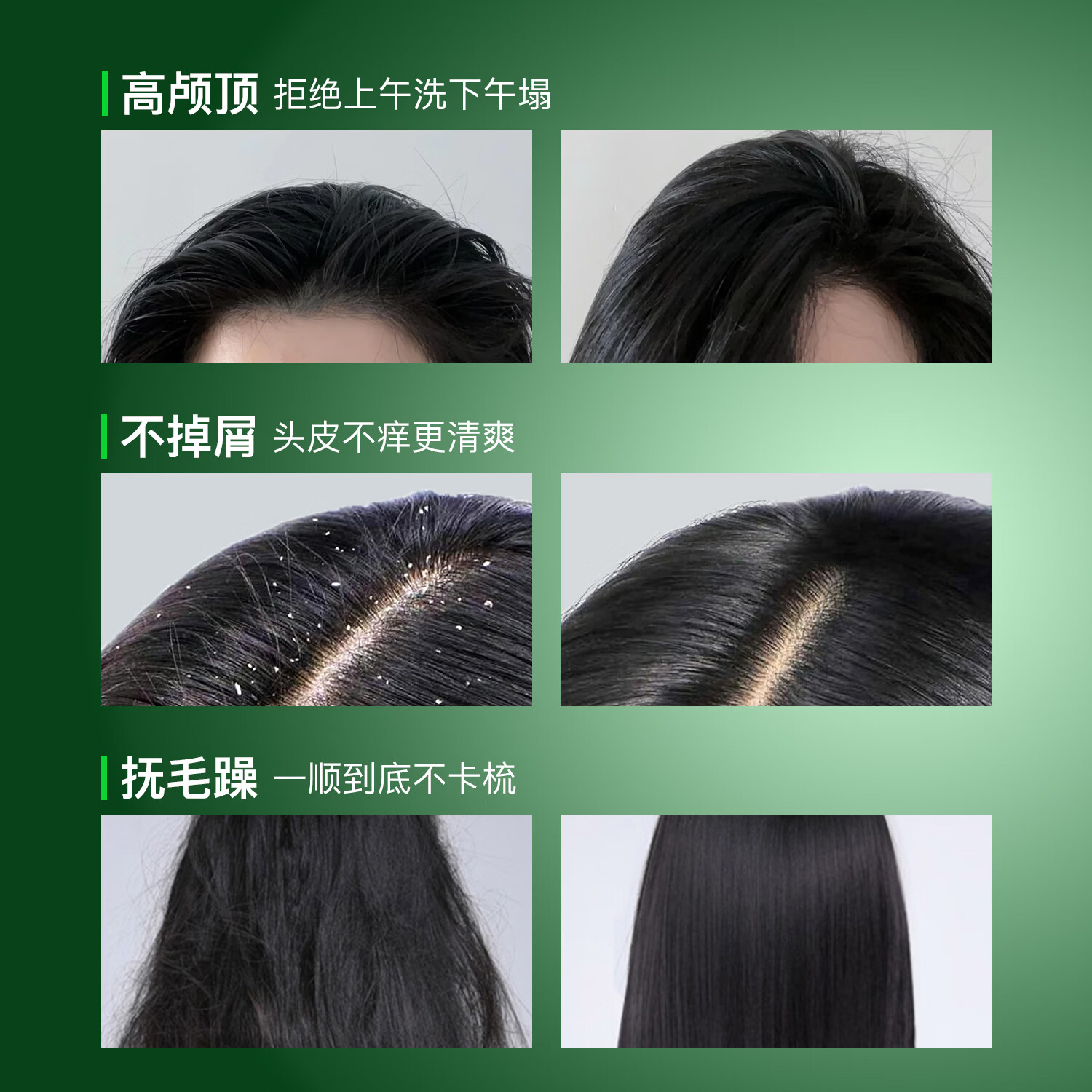 歌拉丝歌专利碳量子点控油溶油柔顺滋养去屑止痒洗发乳大规格750ml洗发水 【热销爆款】专利成分控油洗发乳
