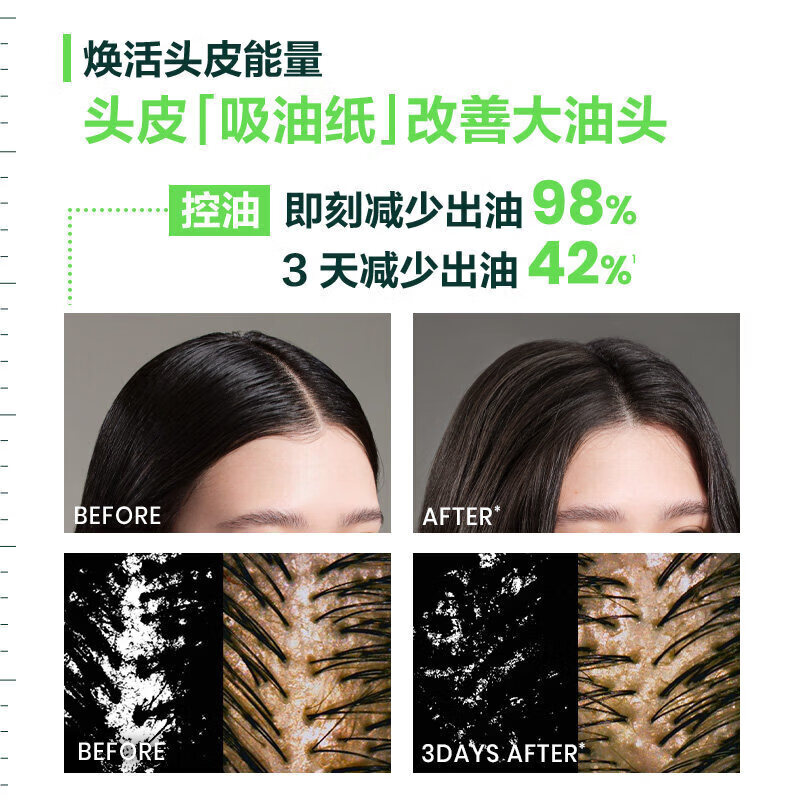 馥绿德雅防脱洗发水馥绿德雅小白珠洗发水强韧头皮防掉控油蓬松无硅油洗发 1支装【体验发正装】 【品质保障 谨防低价假货】