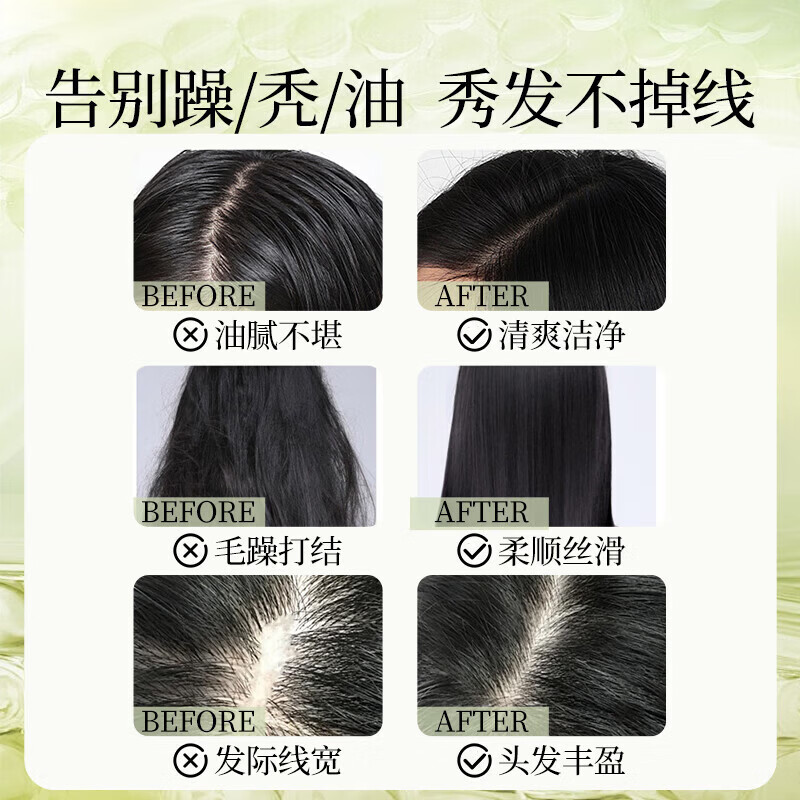 霸王防脱洗发水防断发洗发露大容量生姜控油去屑清洁洗发液男女士 防脱丰盈头皮护理洗发液400mlX2瓶