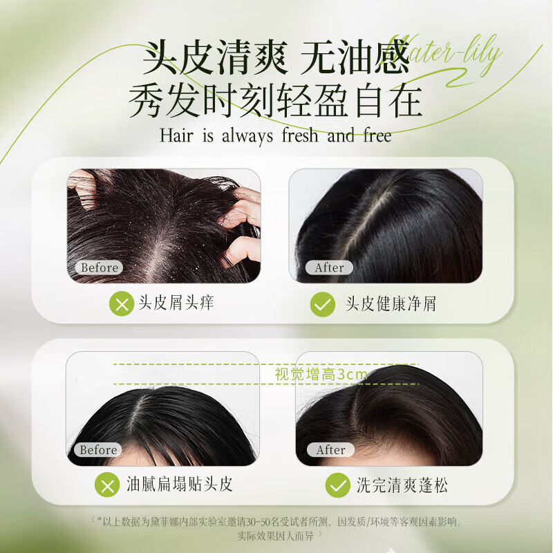 颜之初盈润去屑洗发水止痒持久控油蓬松不扁塌舒缓修护头发 1瓶装【体验发正装】 官方直售