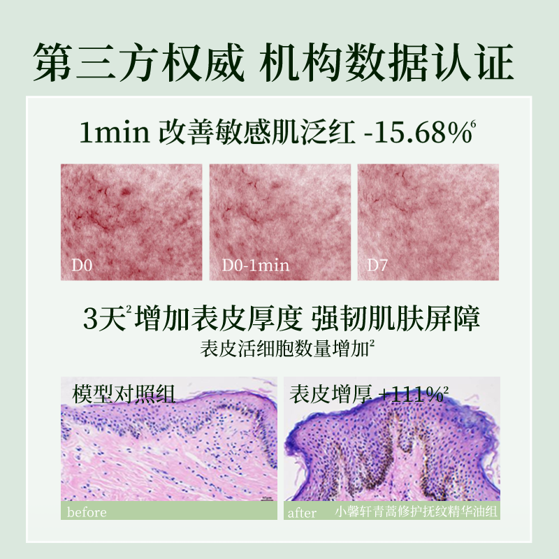 小馨轩青蒿修护抚纹精华油抗皱舒缓面部肌肤官方正品 30ml【超划算】