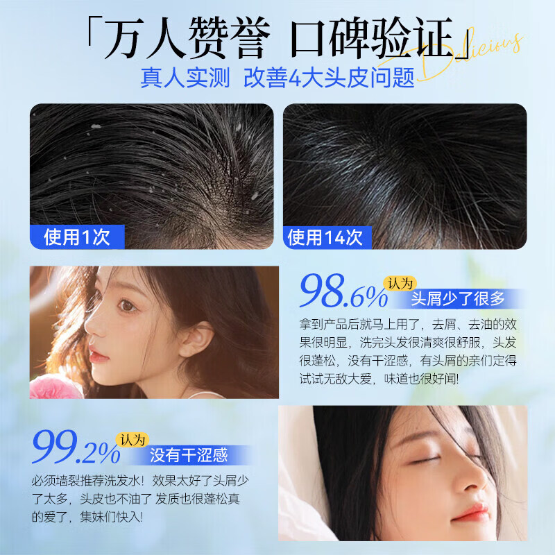 selsun澳洲selsun洗发水二硫化硒去屑黄瓶止痒控油蓬松无硅油洗发露 黄色【去屑止痒】 澳洲selsun赛逸控油去屑洗发水