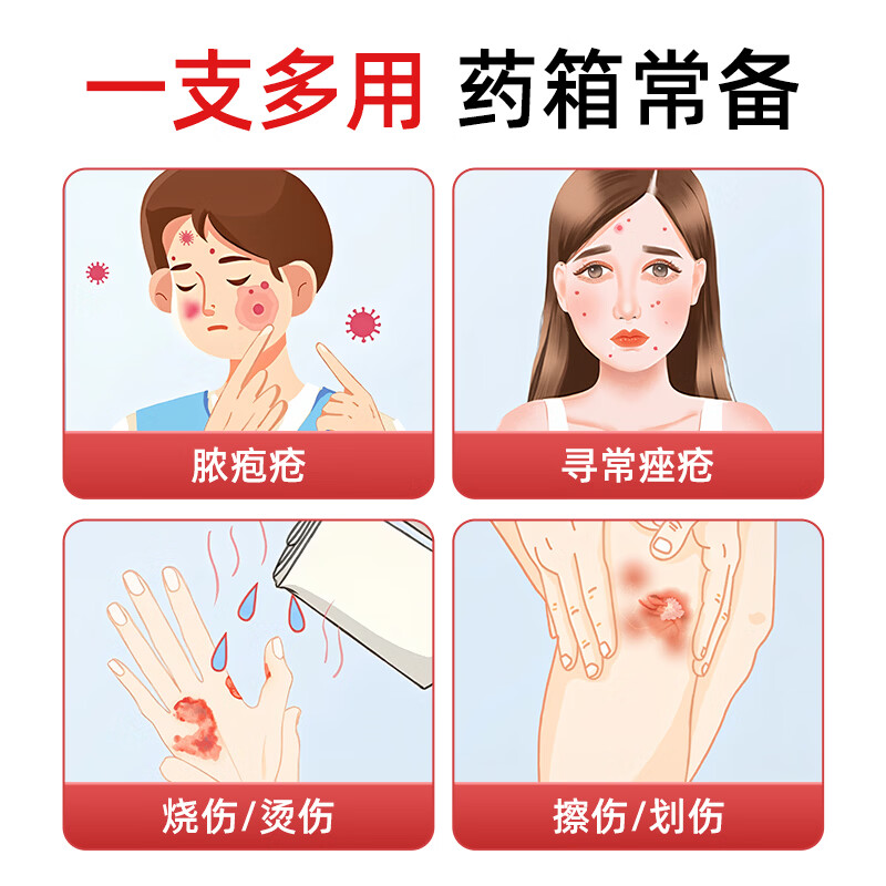 [恒医森]红霉素软膏 1%*18g 4盒装 1%*18g 正品消炎抗菌止痒私处祛痘痘痤疮皮肤瘙痒烧烫擦伤外用药红梅素药乳膏