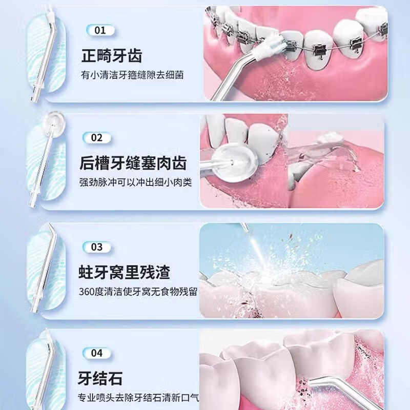 RASW德国冲牙器便携式洁牙器家用电动牙齿洗牙器正畸专用青少年清洁冲洗牙齿牙结石生日礼物 【极光白】 高频脉冲丨洁齿护龈丨塞牙克星 4支喷头 洗牙器冲洗器去牙结石