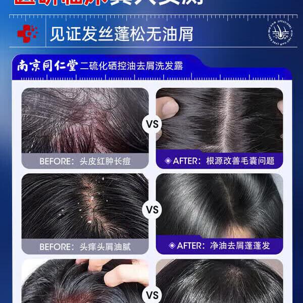 南京同仁堂二硫化硒洗发水去屑止痒控油持久蓬松滋养头皮毛囊清洁头屑无硅油 5瓶【买3赠2】