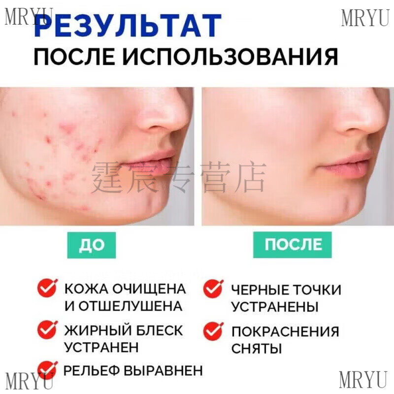 俄罗斯螺旋桨深层清洁面膜泥膜净透肌底控油去黑头细致毛孔泥浆 3支 小蓝管共120ml 火山泥祛痘去粉刺 正品保障