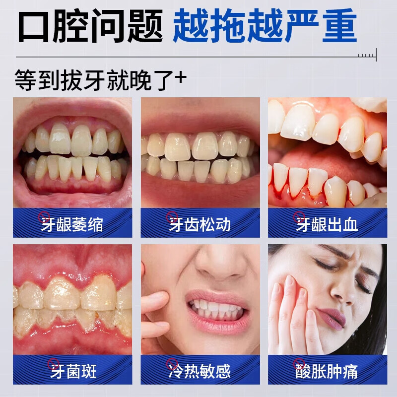 速克欧牙膏去牙结石溶解美白除牙垢速清理有效脱敏牙周i炎口腔肿 1支【装】建多盒更实惠 品牌直售
