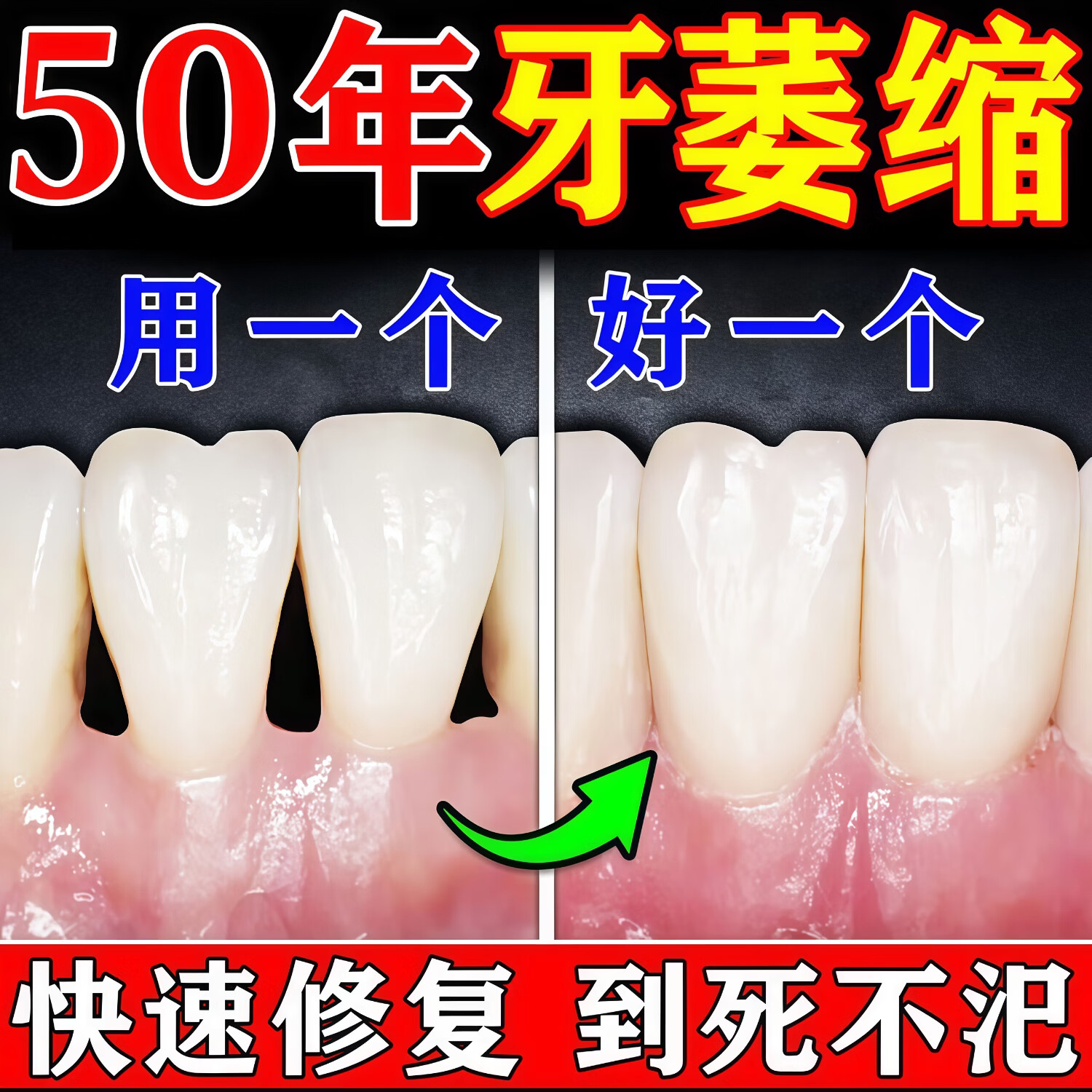 七黎牙龈萎縮专用牙膏护龈固齿修复再生牙周根外露牙齿松炎动正品旗舰 2盒半价【牙齿敏感 牙龈I萎缩再生肿痛出血】无效包退