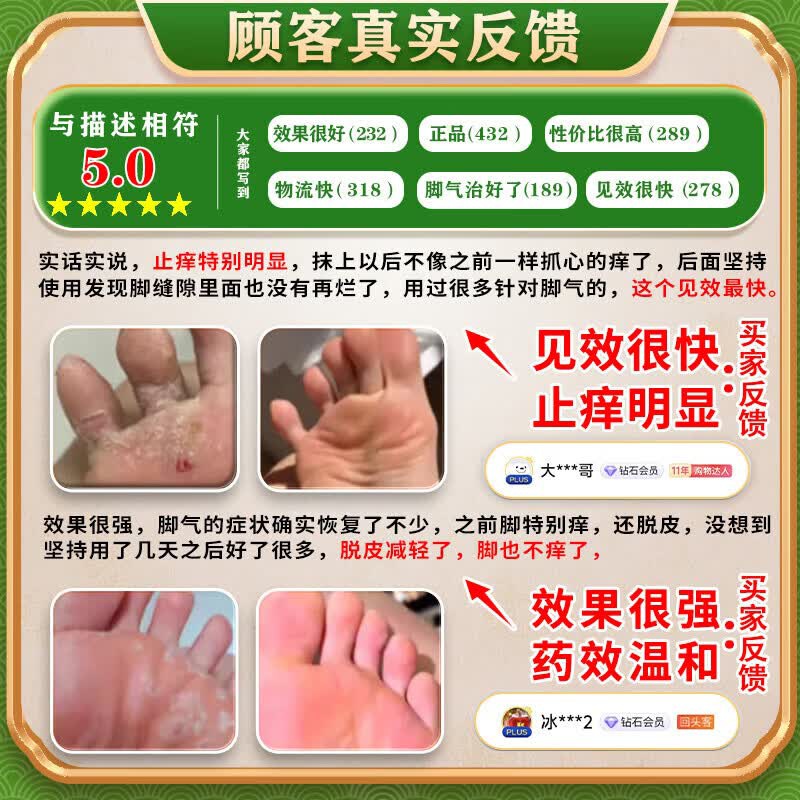 [嘉效]盐酸特比萘芬乳膏 1%*25g 2盒装 真菌感染等抗真菌药脚气药治疗止痒脱皮烂脚丫真菌感染根源治起小水泡痒特强效药 疗程装 脚底水泡脱皮