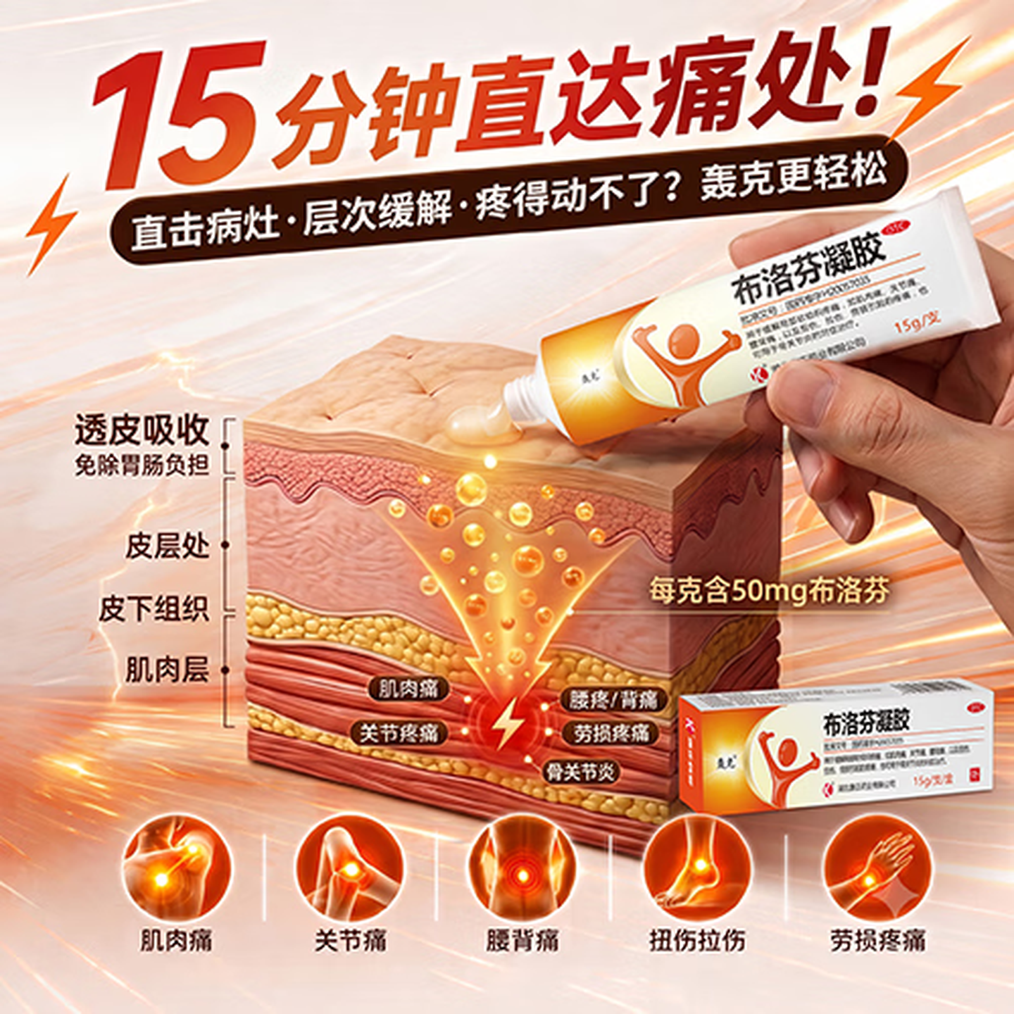 [轰克]布洛芬凝胶 15g:0.75g 1盒装 局部软组织疼痛肌肉痛关节痛酸背痛扭伤拉伤劳损疼痛骨关节炎 赠医用棉签