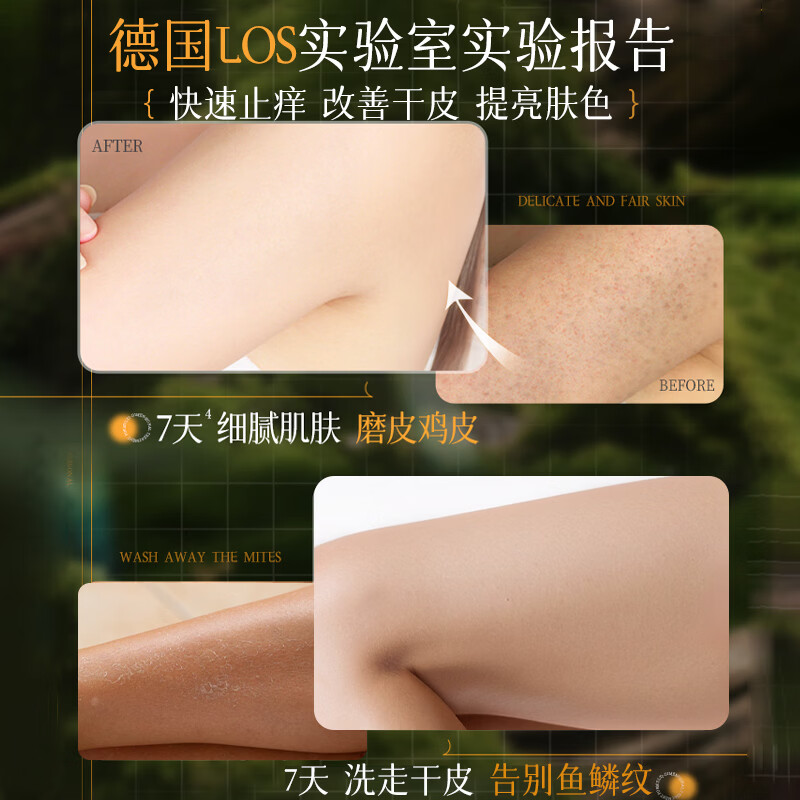 LOSMVFCEE德国沐浴露持久留香72小时香体专用止痒润肤男女沐浴乳液成人 1盒装【止痒润肤 一抹留香】