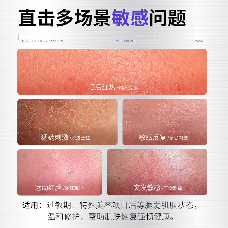 贝护妍贻贝多效修护面膜 补水保湿 盒装(5片/盒)