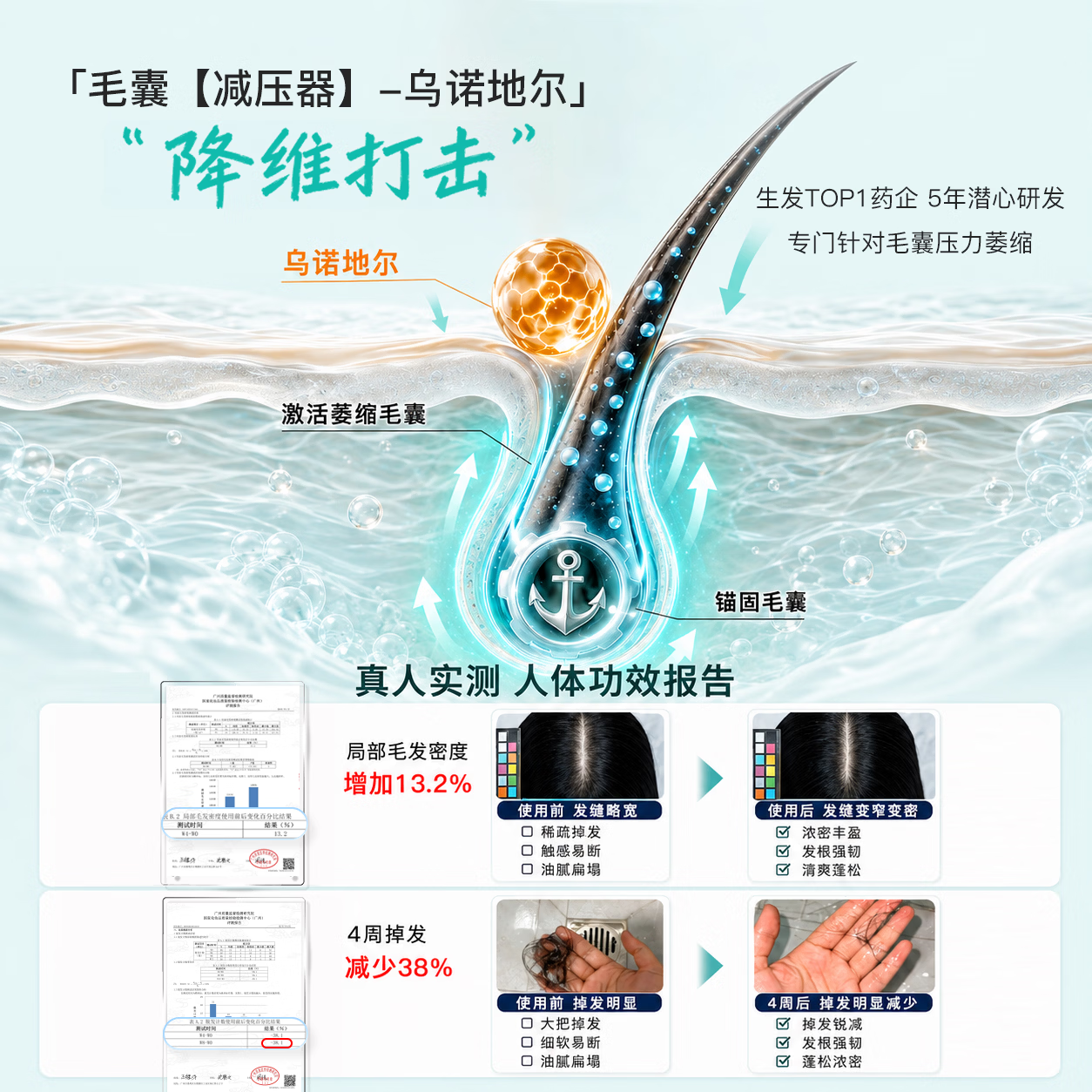 蔓迪【央妈推荐】王耀庆同款防脱固发洗发水200g乌诺地尔（米诺同源） 图 3