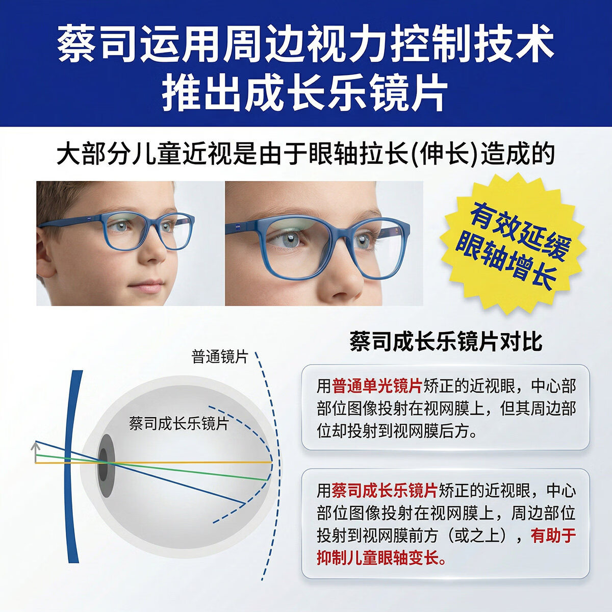 蔡司(ZEISS)成长乐儿童防控镜片减缓近视增长离焦防控多焦点眼镜片小孩子少年 蔡司 成长乐铂金膜【定制片】无散光+送镜框一副 1.60