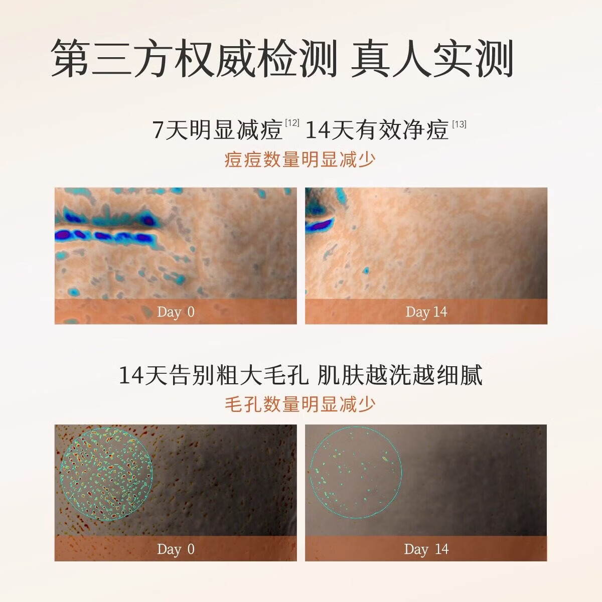 半亩花田氨基酸洁面慕斯泡沫洗面奶洁面乳控油保湿深层清洁男女士正品保障 300g 【尝鲜装】控油更净痘