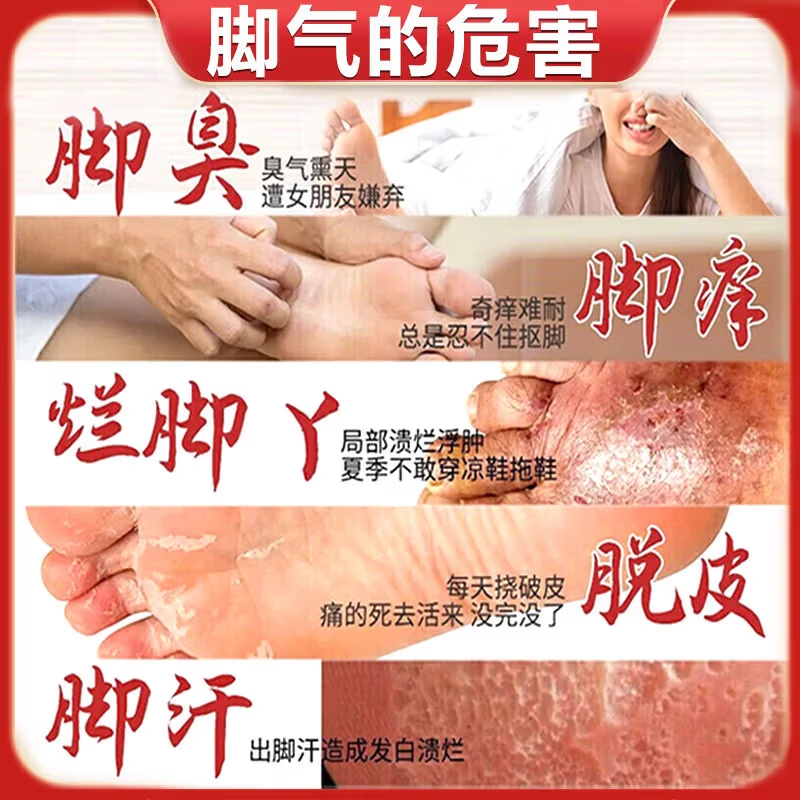 [达克宁]硝酸咪康唑乳膏 治脚气药止痒脱皮烂脚丫真菌感染根药治真菌感染起小水泡痒脱皮药(发货特效) 2%*20g 1盒装 【多盒优惠推荐】