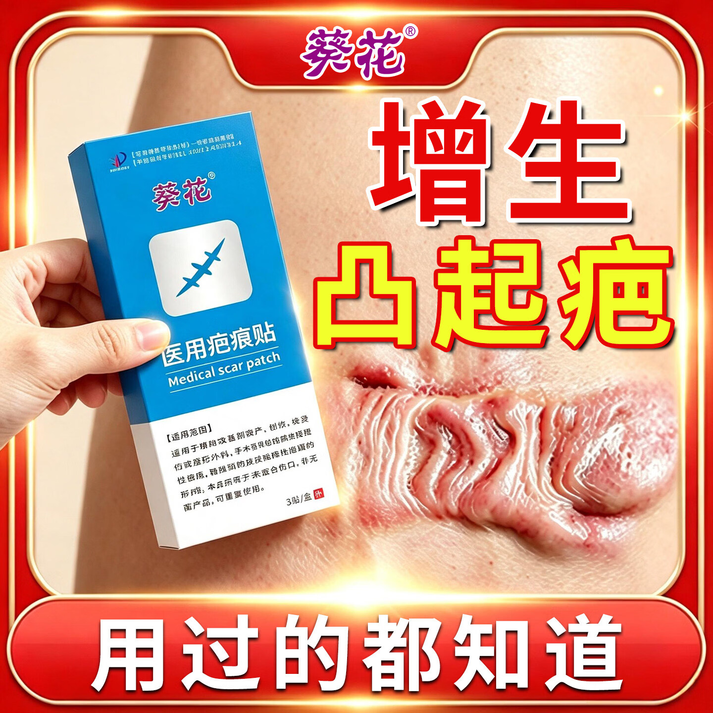 葵花 防增生疤痕贴疤痕增生凸起去除疙瘩止痒烫伤去疤恢复贴缝针术后 单盒【3贴】贴型 京东折扣/优惠券