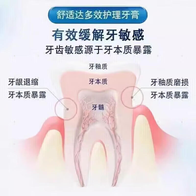 舒适达固齿牙膏牙齿萎缩缓解牙龈劲速
多效护理牙龈脱敏专用劲速护理 劲速护理二支装120克 直售