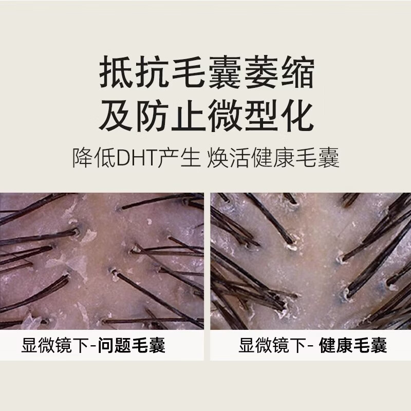 海瑟薇 HASERVEY生姜洗发水两件套控油去屑强韧柔顺氨基酸套装蓬松男女士洗头膏 生姜健发护发素460ml*1瓶