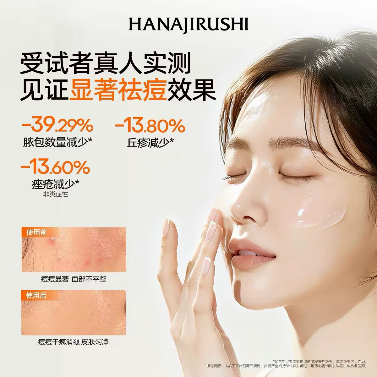 花印进口祛痘凝露面霜精华凝胶淡化青春痘印痘肌急救护肤品教师节礼物 进口祛痘补湿凝露面霜 25g*2
