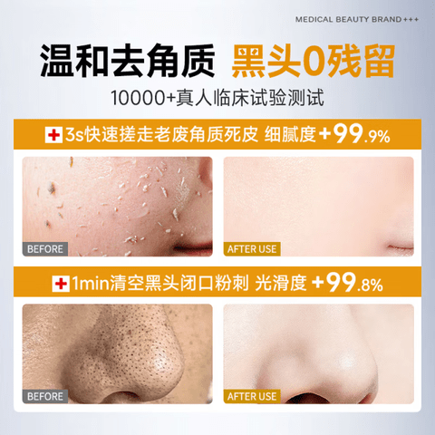 芭倍琪去角质慕斯净澈亮毛孔改皮肤善粗糙深层清洁收缩毛孔去死皮 一瓶体验装【贵在运费】 【全新配方 新品上市】
