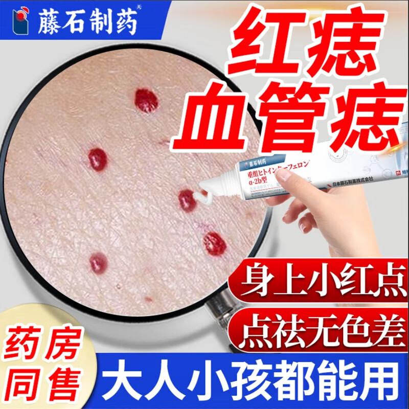 【日本监制】血管瘤专用凝胶血管痣修复红痣头上长红痣樱桃草莓状红