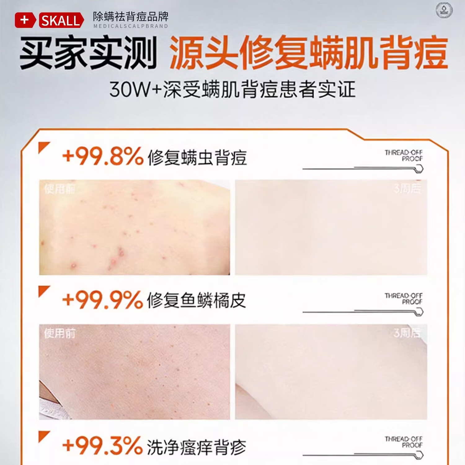 胖东来商城蛇胆硫磺除螨沐浴露止皮肤清洁痒后背祛控油痘祛男女代购 胖东来硫磺蛇胆净肤净满沐浴露5瓶【买3贈2】 胖东来京东线上超市硫磺蛇胆沐浴露官方