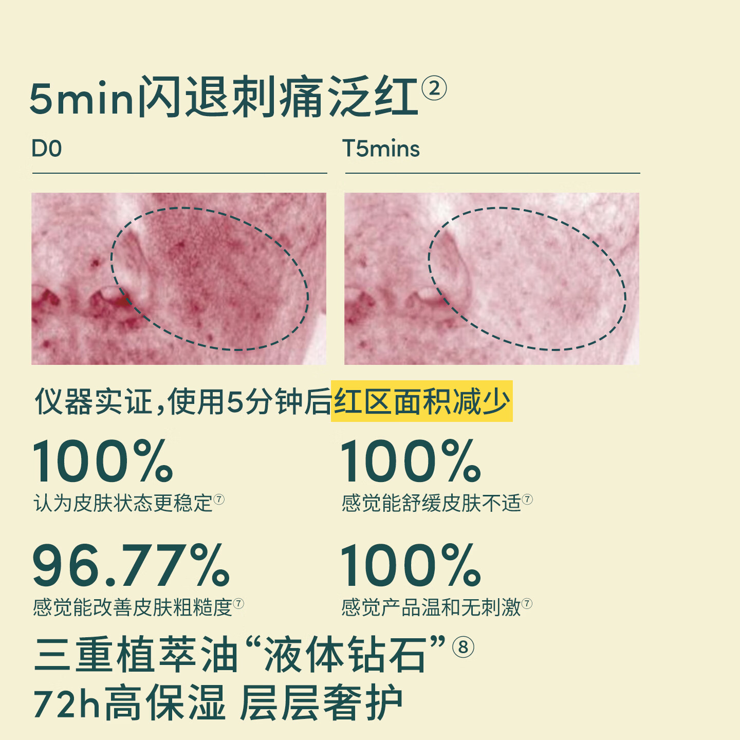EVER EDEN安唯伊婴儿胎脂抚触油舒缓保湿宝宝按摩油小金瓶118ml 婴儿胎脂抚触油118ml