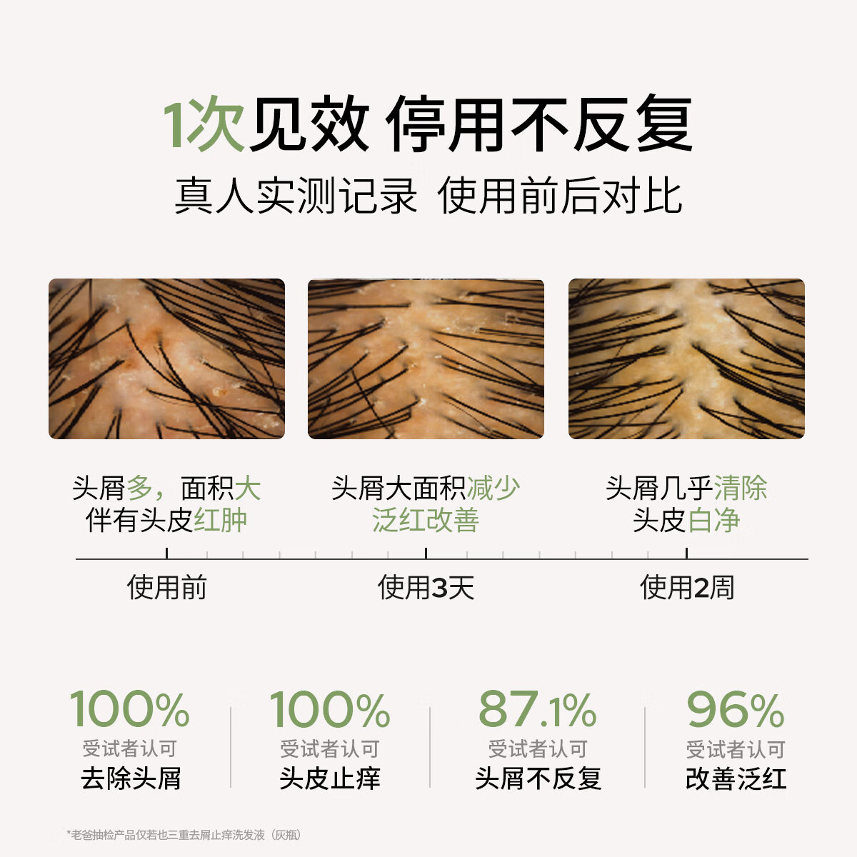roye【老爸评测】若也去屑止痒洗发水青蒿控油蓬松洗发露大容量洗头膏 【72h控油去屑】去屑止痒+控油蓬松472ML