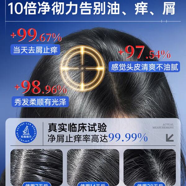 南京同仁堂二硫化硒洗发水去屑止痒控油持久蓬松滋养头皮毛囊清洁头屑无硅油 5瓶【买3赠2】