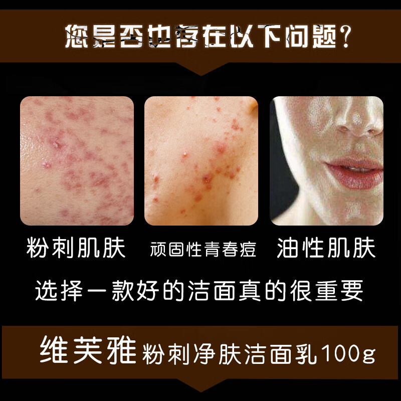 维芙雅维生素E氨基酸保湿洁面乳清洁面部污垢泡沫绵密粉刺洗面奶女男 粉刺净肤洁面100g*1支