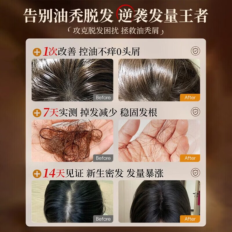 上山村洗发皂铁皮石斛首乌固发防脱养发去屑止痒控油蓬松滋养发根 三盒【超值装】买三免一 官方严选/臻品好货