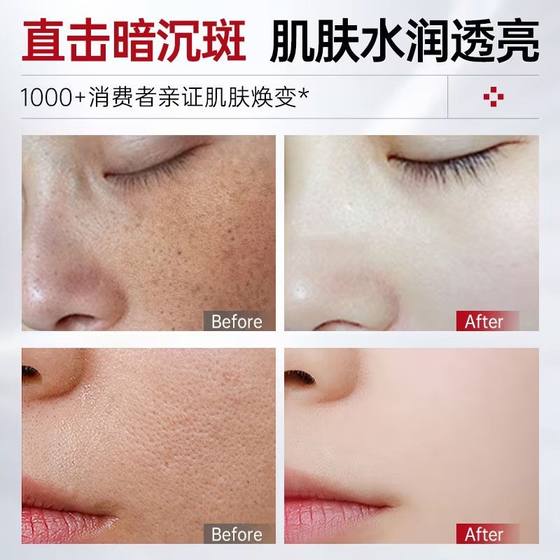 儒意 本活亮肤美白安瓶精华液美白淡斑提亮肤色去黄改善面部暗沉肤色 【美白淡斑】进阶冷白皮*3