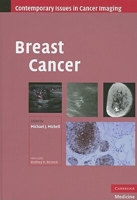 预订 breast cancer