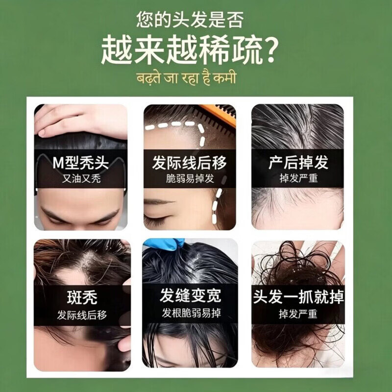 阿育吠陀洗发水印度官方防脱发固发养发去屑止痒滋养发根改善 五瓶【囤货装】买五免二 官方严选/臻品好货