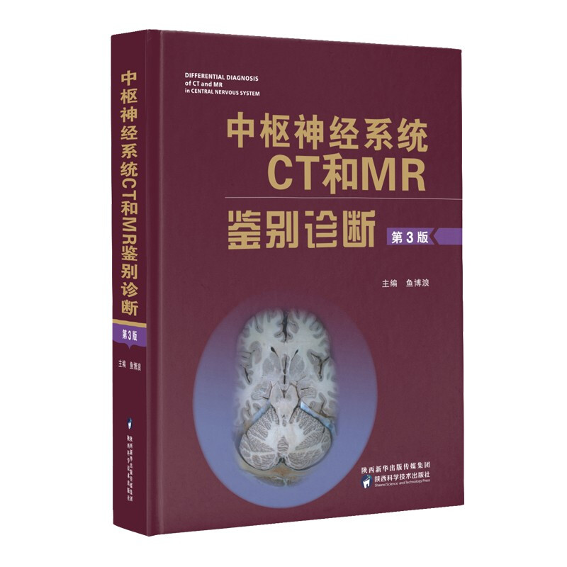中枢神经CT和MR鉴别诊断(第3版)