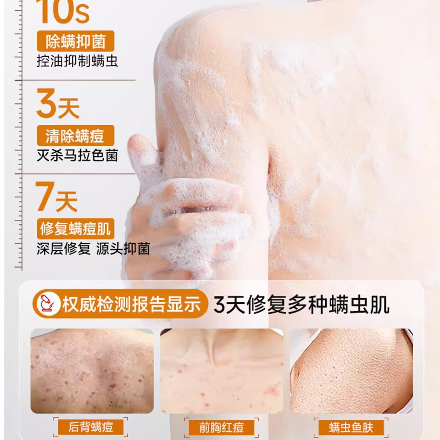 胖东来商城蛇胆硫磺除螨沐浴露止皮肤清洁痒后背祛控油痘祛男女代购 胖东来硫磺蛇胆净肤净满沐浴露5瓶【买3贈2】 胖东来京东线上超市硫磺蛇胆沐浴露官方
