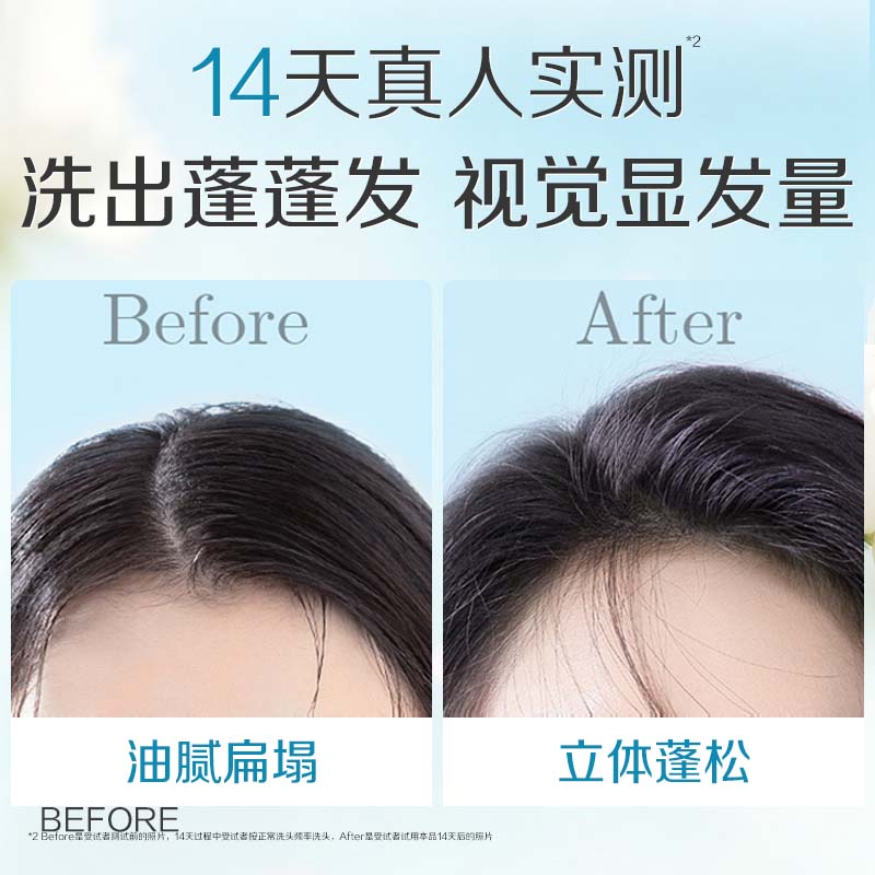 阿道夫洗发水600ml去屑控油蓬松留香洗头膏护发柔顺沐浴露套装男女士 祛屑蓬松洗发水518ml+清爽保湿沐浴露600ml 72h留香