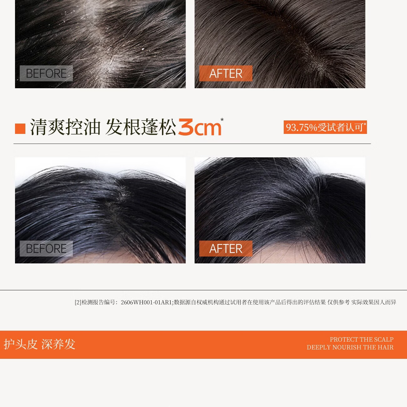 云康升级去屑止痒护发洗发水二硫化硒持久蓬松控油留香洗头膏液露洗剂 全新配方二硫化硒重度问题头屑【调理头皮环境】330g
