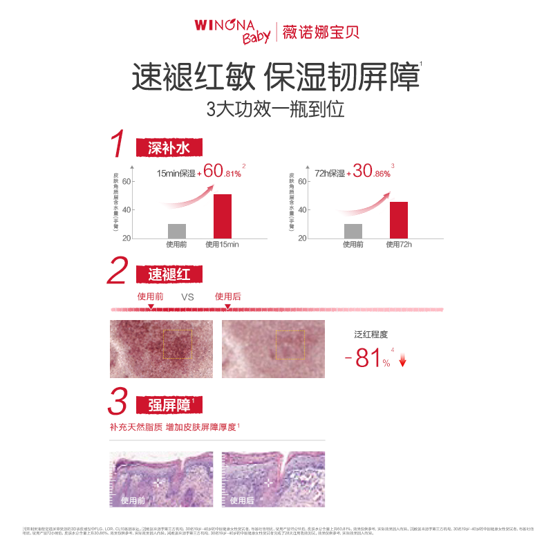 薇诺娜宝贝舒润亲肤护肤油屏障小金油宝宝身体抚触油润肤精油新生儿按摩油 【新生儿抚触油】屏障小金油50ml
