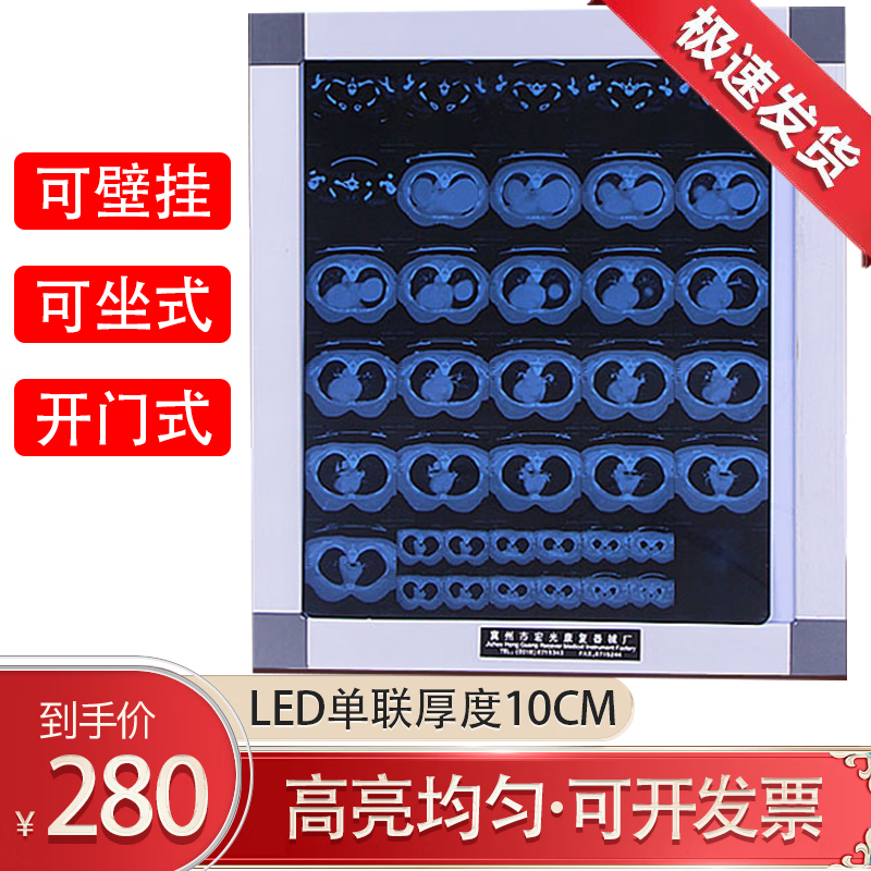医用观片灯箱 骨科阅片x光胶检查超薄x光观片灯箱医用led看片灯箱哪