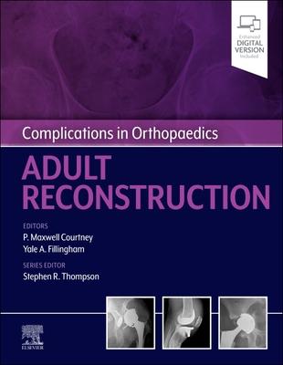 预订complications in orthopaedics: adult reconstruct